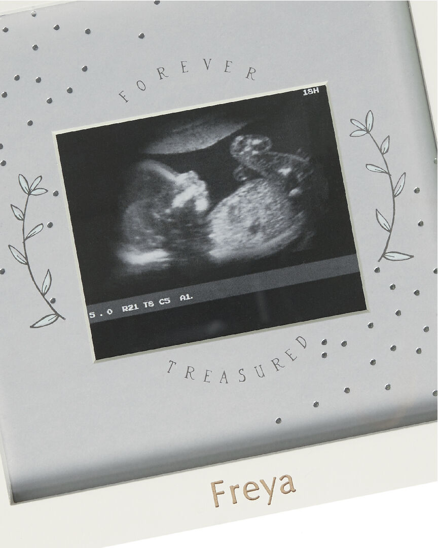 إطار صور الموجات الصوتية فور ايفر تريجرد - أبيض image number 2